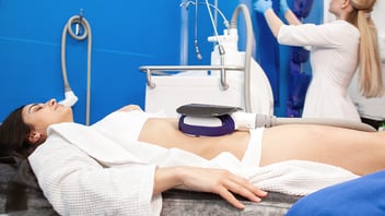 CoolSculpting